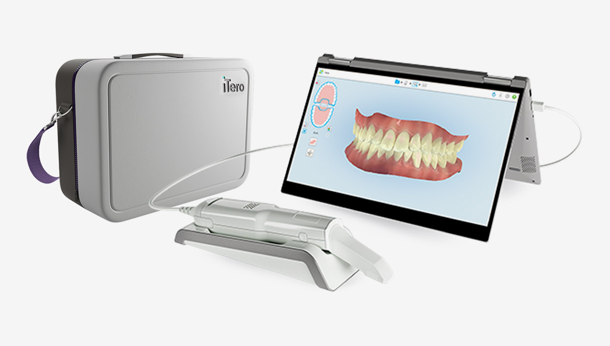 Itero Flex Case Product